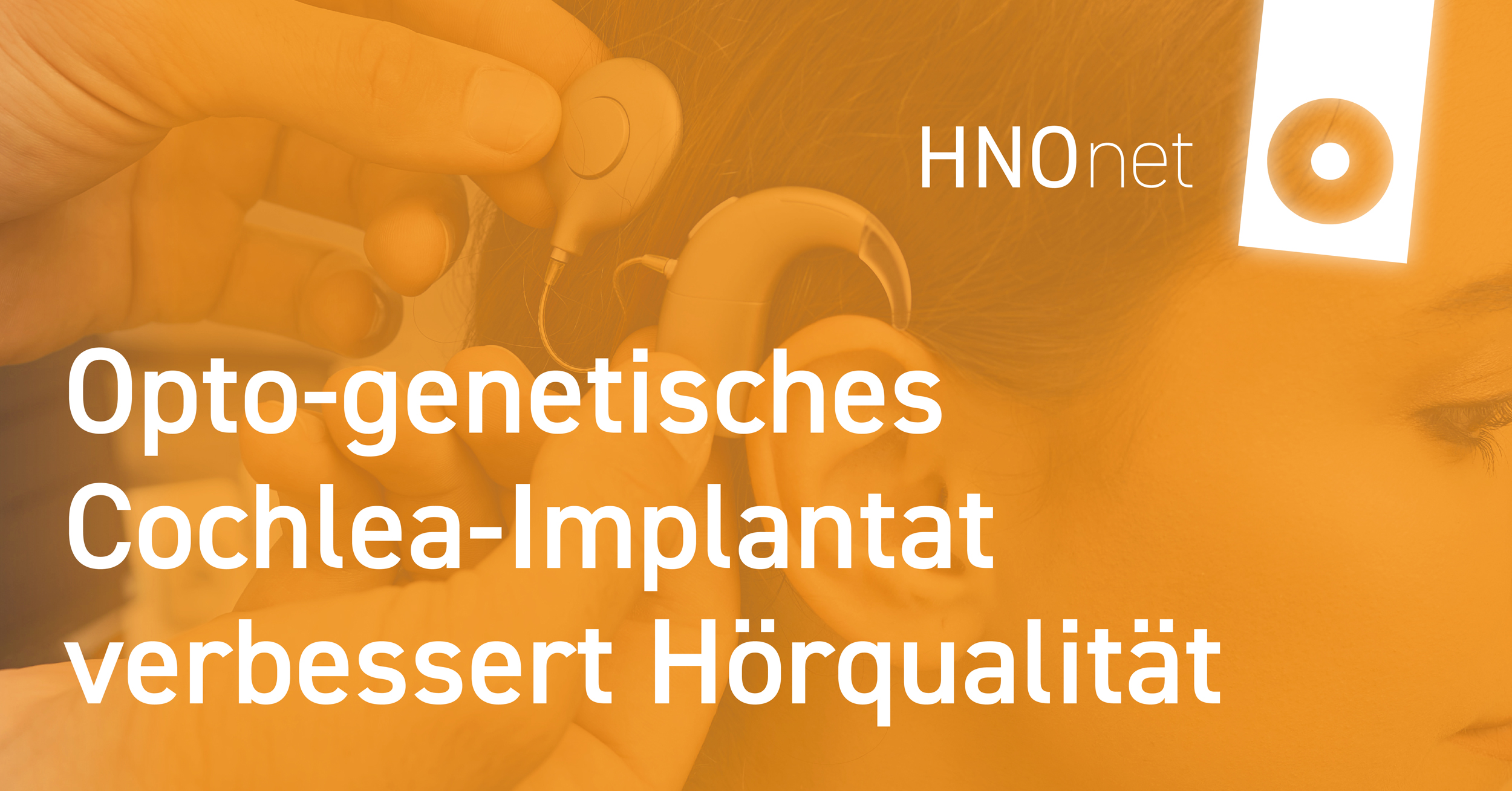Opto genetisches Cochlea Implantat